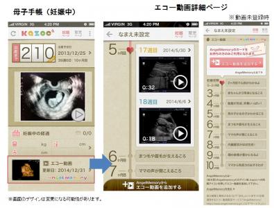 動く母子手帳 赤ちゃんの超音波動画や心音がスマホで Ecのミカタ 動く母子手帳 赤ちゃんの超音波動画や心音がスマホで Ecのミカタ
